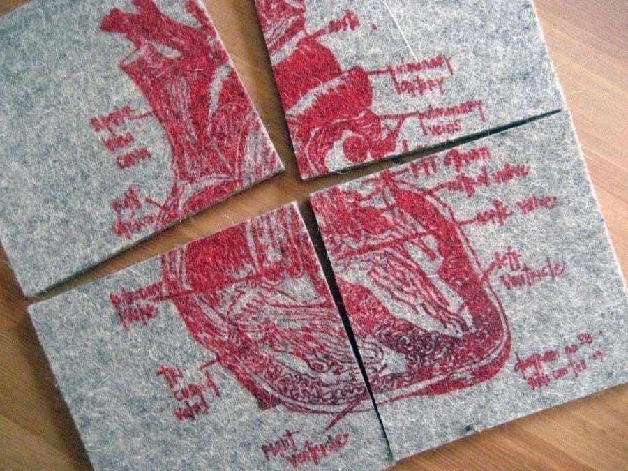 Anatomical Heart coasters - broken heart diagram coaster set