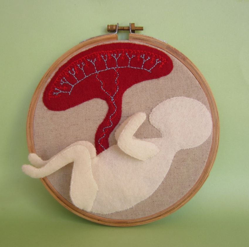 Placenta and Foetus Wall Hoop
