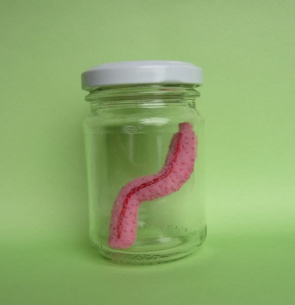 Your appendix in a jar could be the ultimate frugal gift idea