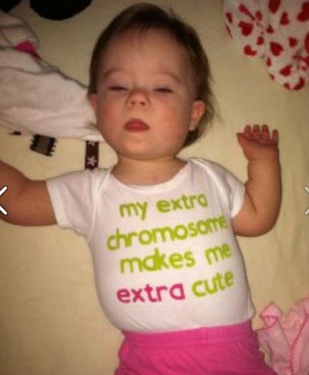 Down Syndrome Awareness Onesie--My Extra Chromosome Makes Me Extra Cute