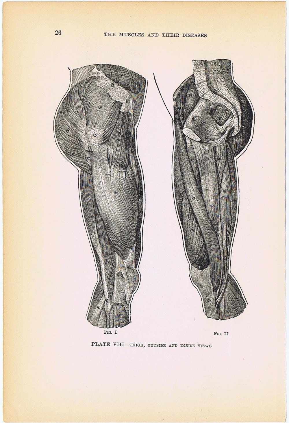 1919 HUMAN ANATOMY Print Pl VIII  'Thigh, Outside and Inside Views', Ideal for Framing or Altered Art Project, Anatomy, Butt Cheeks
