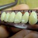 CREEPY SALE: 2x1 Pay one, get two. Acrylic human teeth. Perfect for your crazy crafts. UPPER teeth