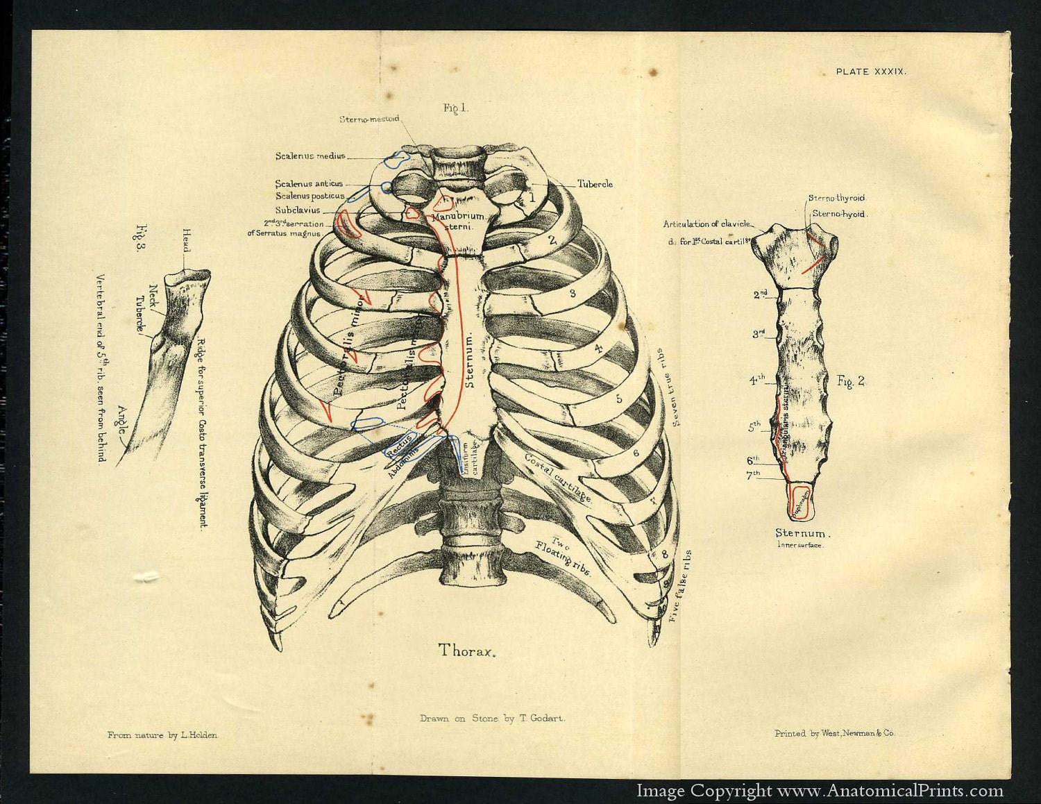 1887 Human Anatomy Print Of The Rib Cage And Sternum By Aprints