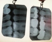 Dental X-Ray Earrings