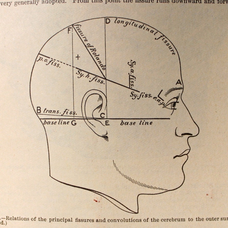 Old Medical Diagram