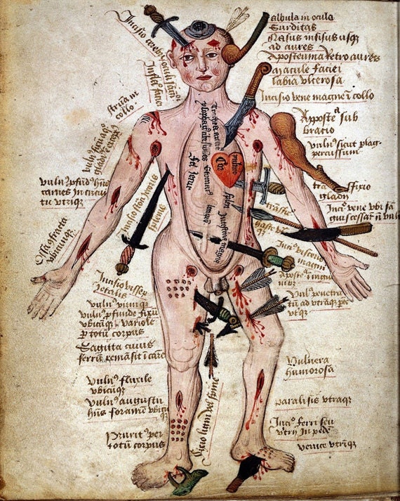 Vintage Medical Illustration "Wound Man" Antique Anatomical Diagram - Medieval Gothic Spooky Surreal Skeleton