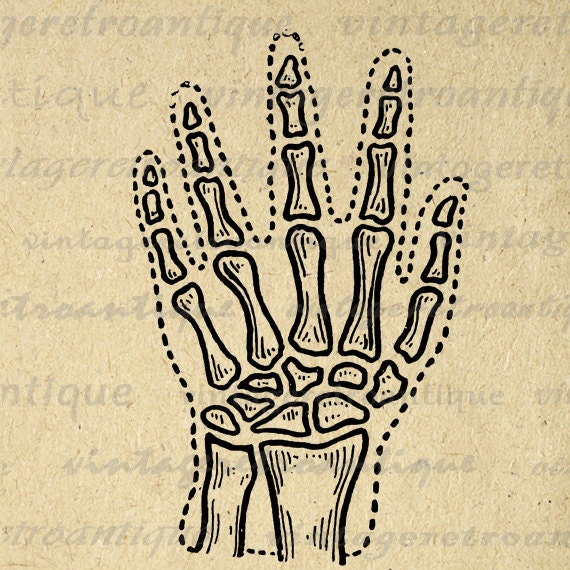 hand x ray clipart - photo #40