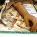 Vintage Prosthetic Arm and Hand