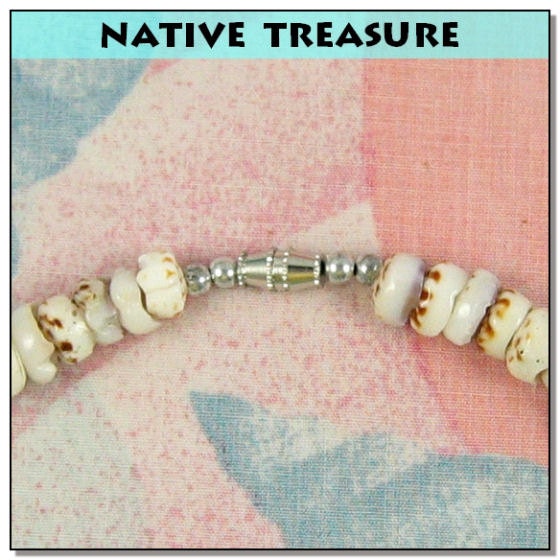 Native Treasure Tiger Puka Shell Necklace Surfer Beach Choker - 8mm (5/16") - 18" Inch