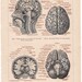 1894 human brains antique anatomy print original lithograph