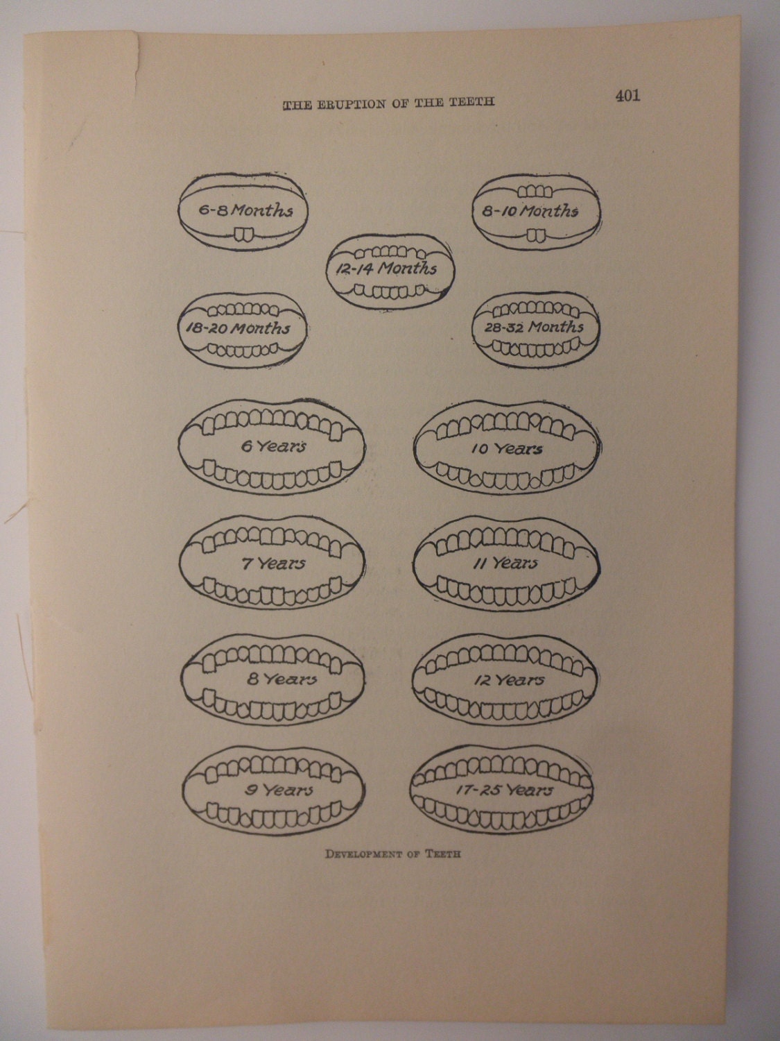 1905 original page from antique medical book - Growth of Teeth
