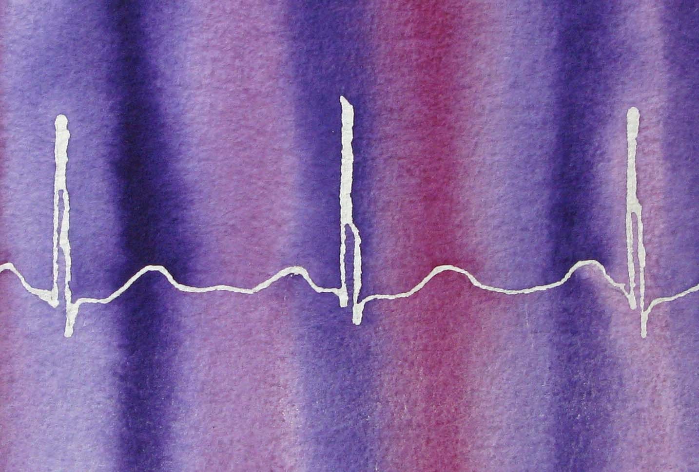 Fairly Normal Heartbeat (purple - original watercolor ekg painting