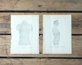 Antique Anatomical Book Plate Print / Male Body, Ailments, Medicine