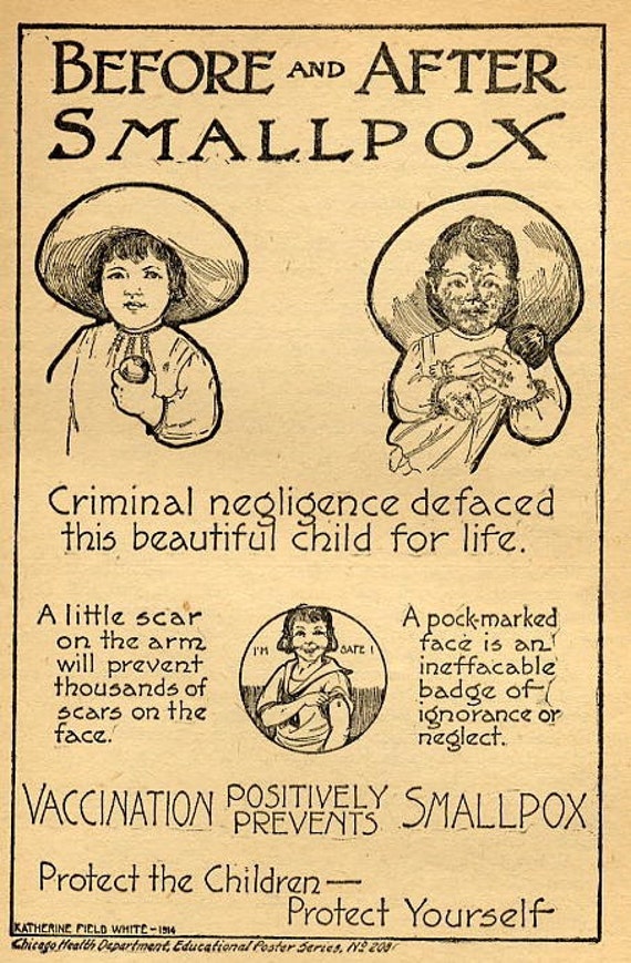 Antique 1800s Medical Home Care Book Illustrations Smallpox