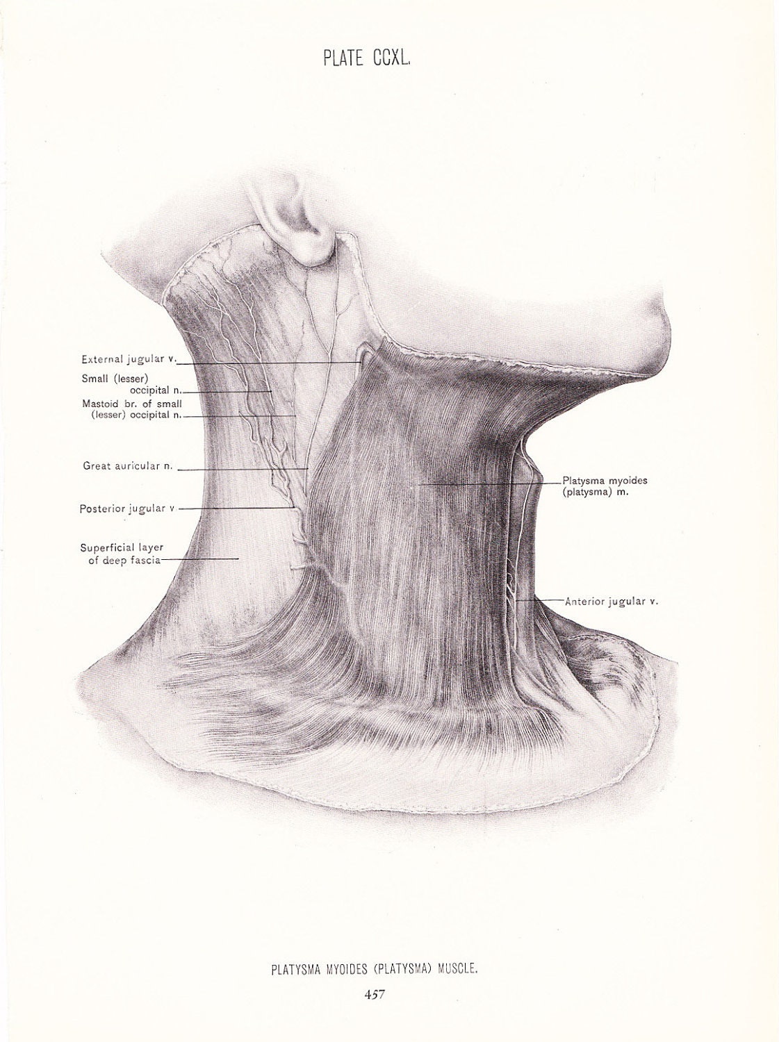 1926 Human Anatomy Print Platysma Myoides Muscle of Neck