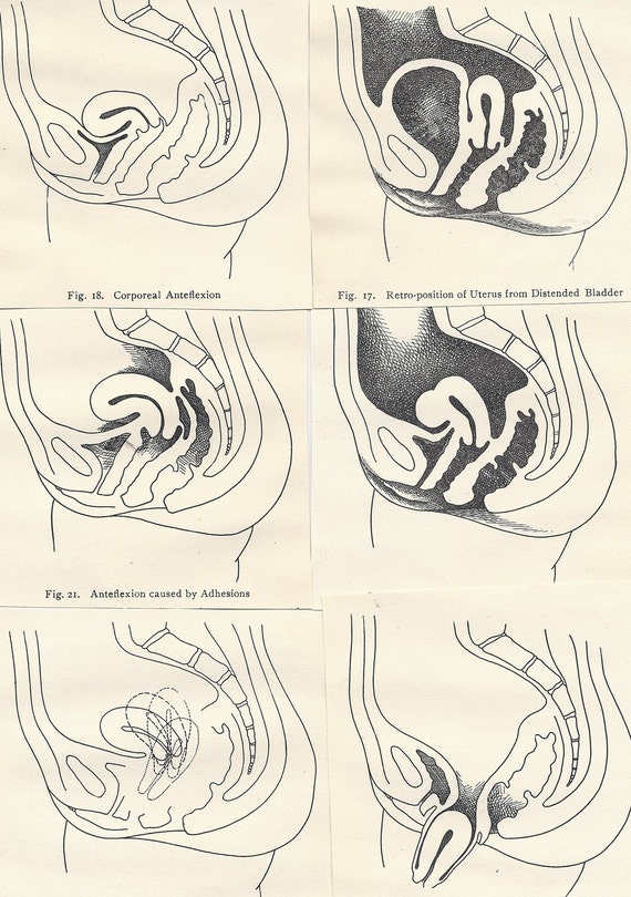 Vintage Gynecology Illustrations 38 Clippings from 1930s