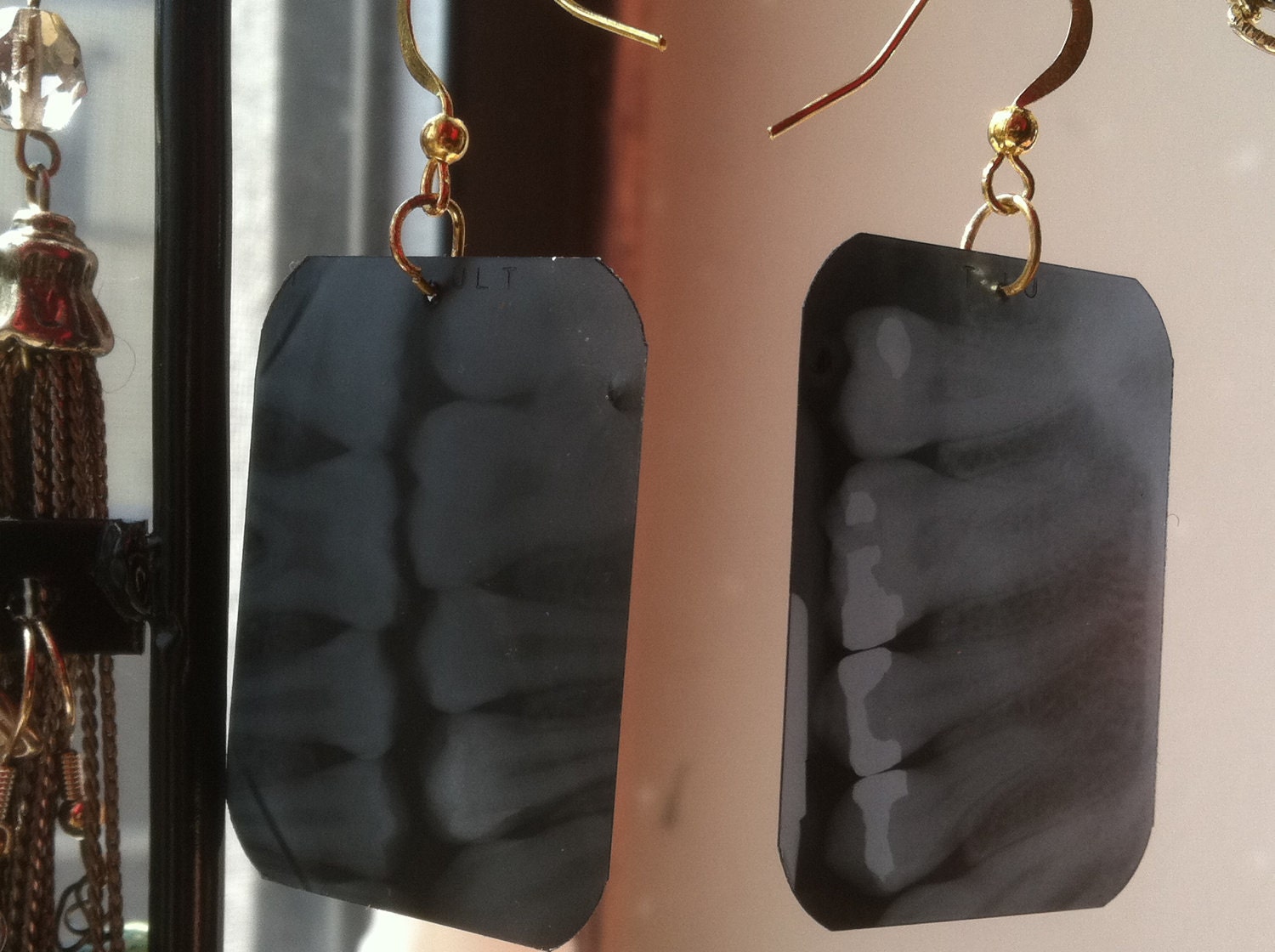 Dental XRay Earrings