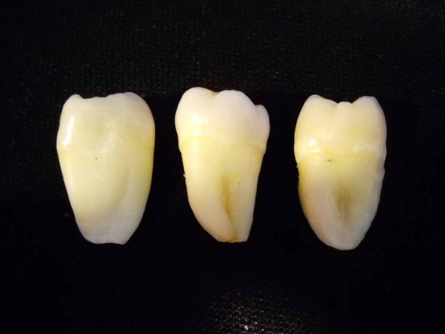 3 Premium Real Human Teeth Taxidermy Bone Teeth Molars Tooth