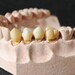 Vintage French dental mold teaching aid with 4 real teeth