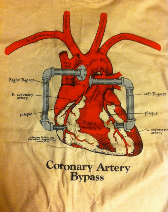 Vintage Medical Heart Coronary Artery Bypass Diagram Model