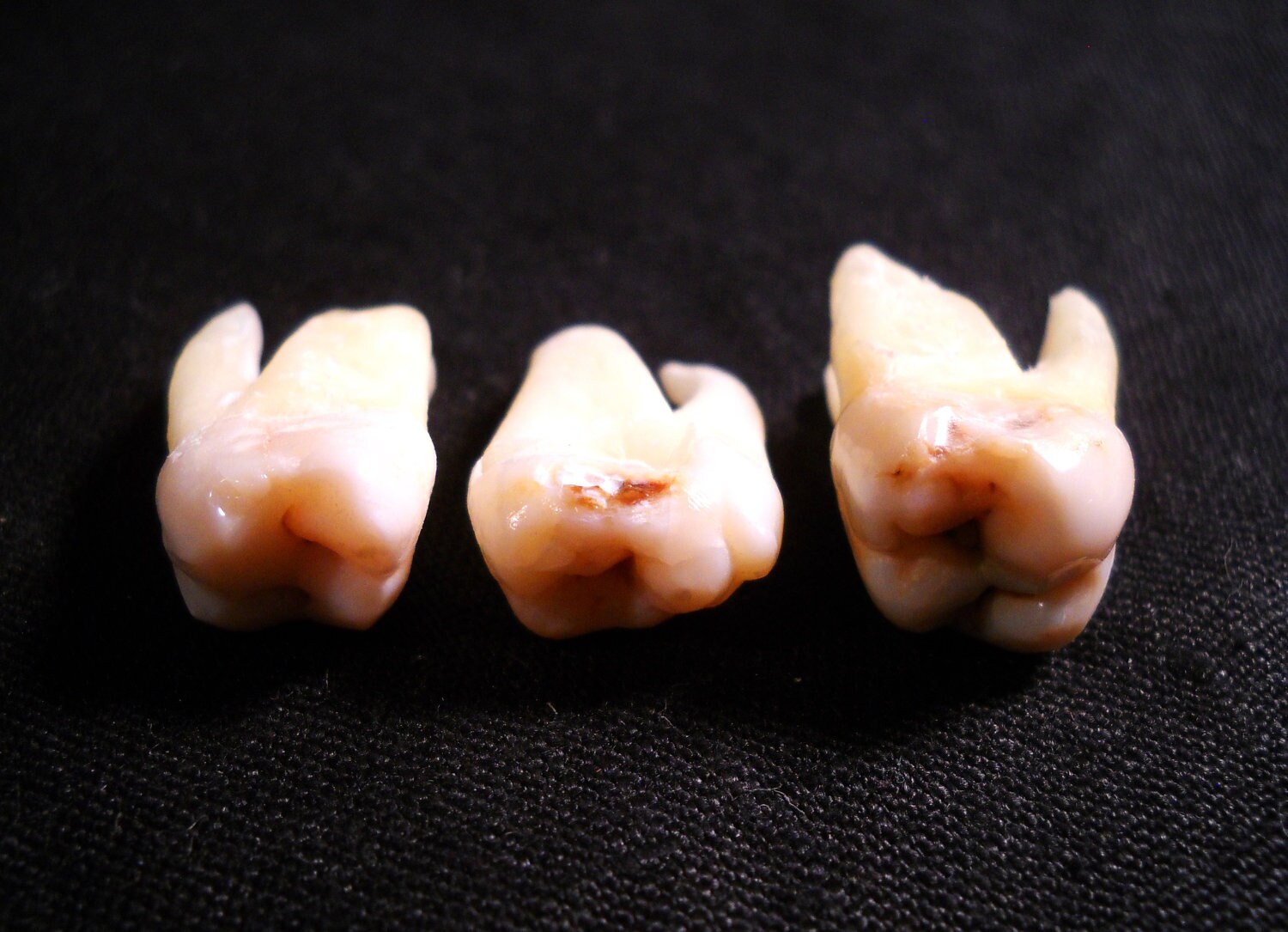 3 XL Premium Real Human Tooth Taxidermy Bone Teeth Molar and