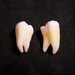 2 Premium Real Human Teeth Taxidermy Bone Teeth Molar Tooth Bones lot 85