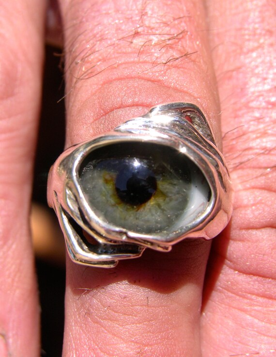 Gelstix ring prosthesis 04 picture