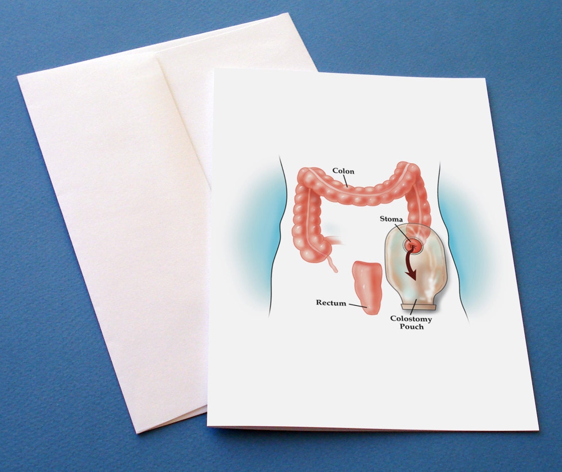 Ostomy greeting card