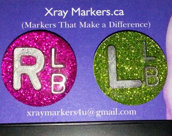 Xray Markers that Make the Difference