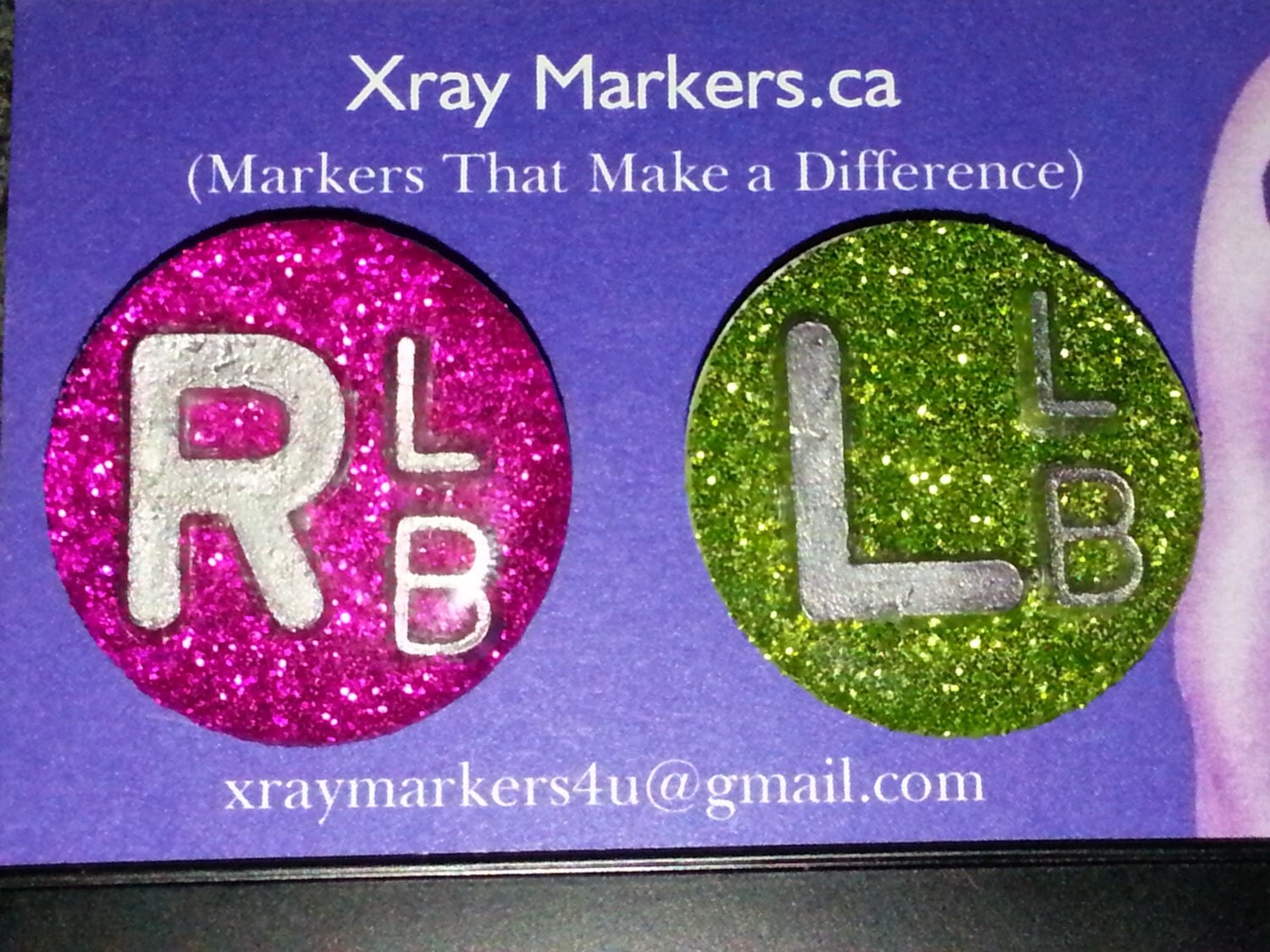 Xray Markers that Make the Difference