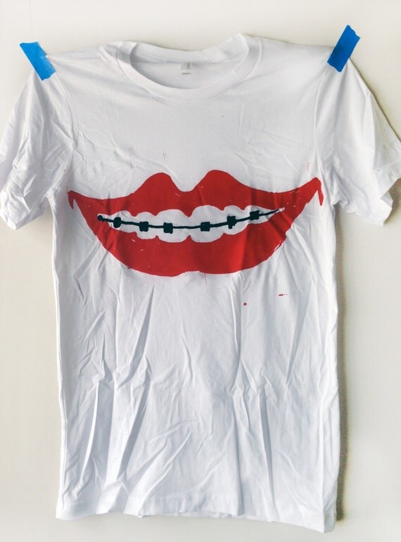 Braces Tshirt