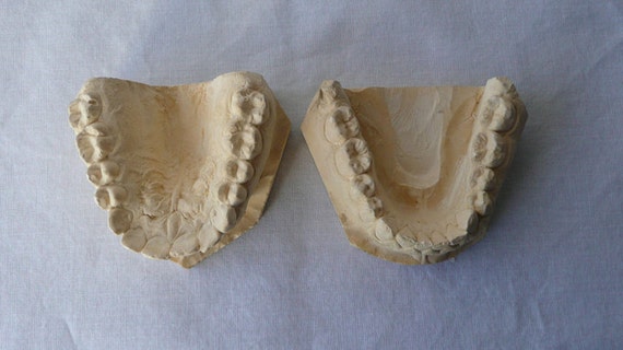 Plaster Dental Teeth Mold 1 by aldetha on Etsy