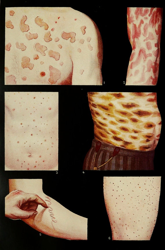 1922 Antique DERMATOLOGY bizarre print. Human Skin and its