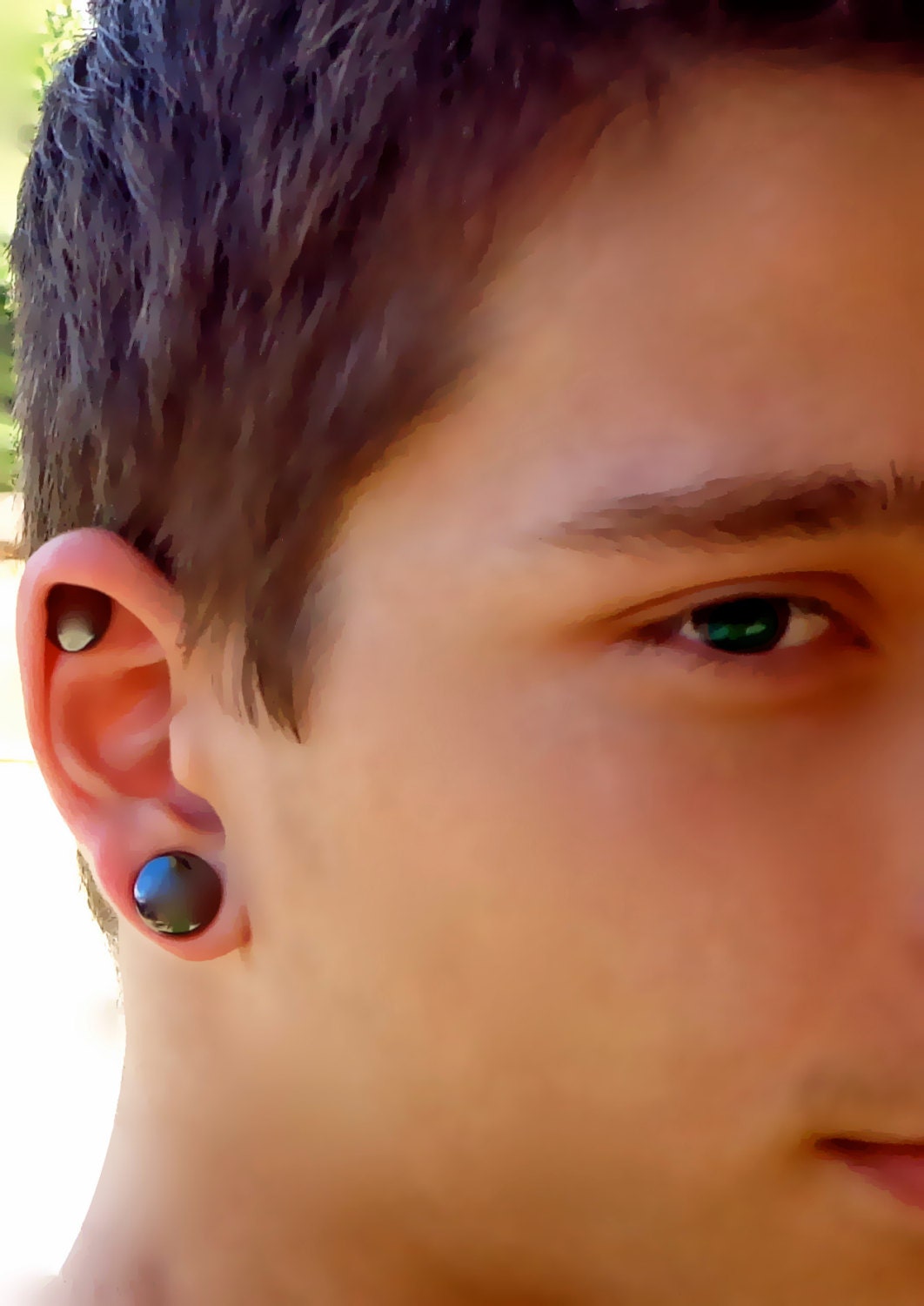 compression earring keloid
