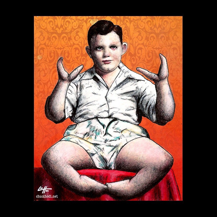 Print 8x10 Lobster Boy Grady Stiles Ectrodactyly