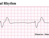 Items similar to Agonal Rhythm ECG Strip on Etsy