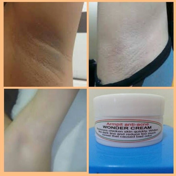 armpit anti acnecream by creatorschoice on Etsy