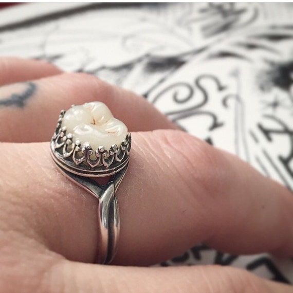 Molar Tooth Denture Ring silver by oakandscarlatina on Etsy