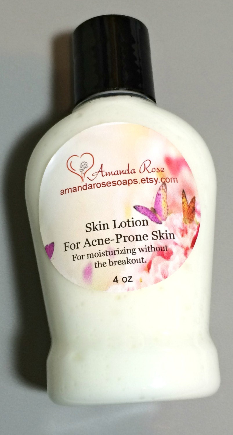 Moisturizing Lotion For AcneProne Skin body lotion light