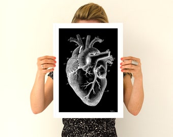 Summer Sale Human heart, black poster Anatomy Anatomical art prints, wall art poster gifts for him , gifts for doctor SKA124WA3