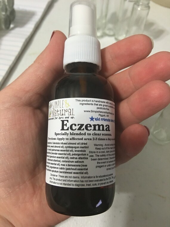 Eczema relief herb oil and essential oil blend. by SimpleNaturalPC