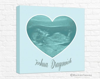 Fathers Day Gift, Ultrasound picture on canvas, Sonogram print, Ultrasound canvas, Sonogram art print, Expecting parent ultrasound canvas