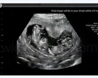 Fake 5-8 week twins Ultrasound/Sonogram/Gag by WickedTooth on Etsy