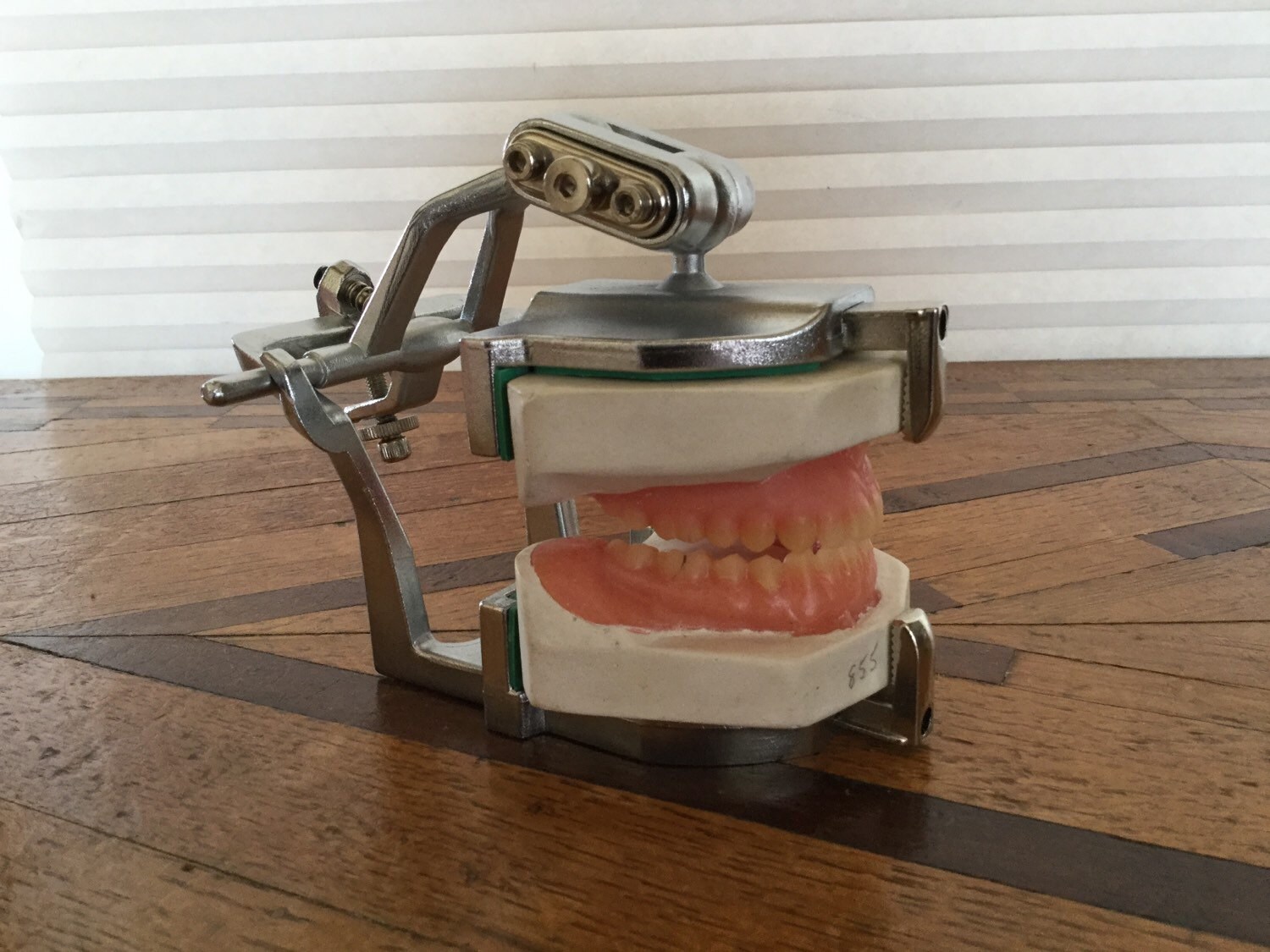 Vintage Dental Articulating Jaw Model