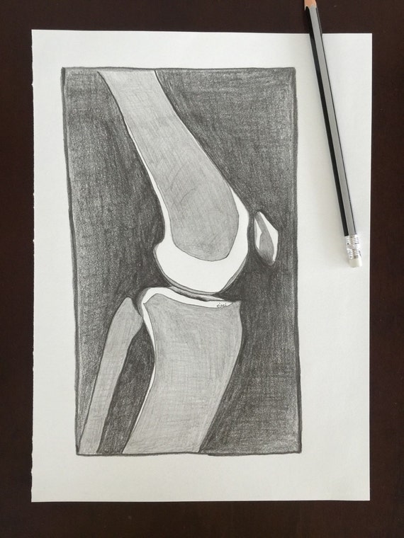 wall art original knee x-ray drawing human by penciledbynicole