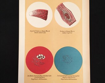 1916 Medical Print - The Cholera Germ, Original 7x10 Print, Antique Color Lithograph