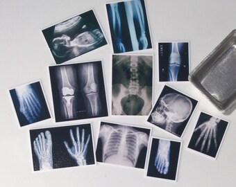 Set of Eleven, Clear, X-Ray, Photos, Dollhouse Miniature, 1/12 scale - 1 inch, medical, anatomy, surgery, medical, Doctors, bones, Study,