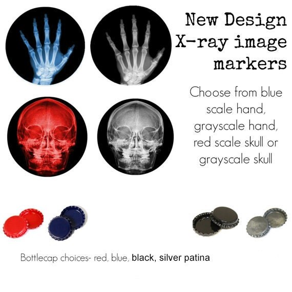 Xray image radiographic markers 2 markers per set