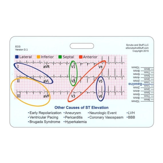 stemi reference tool horizontal badge pocket card for nurse