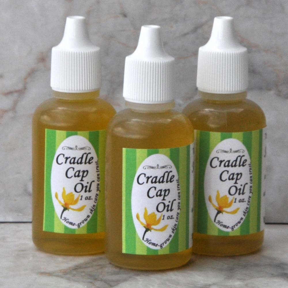 Cradle Cap Oil by skintasticcreations on Etsy